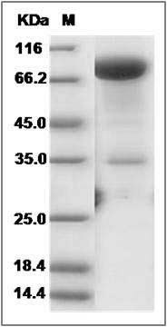 Cynomolgus IL1R2 / IL1RB Protein (Fc Tag) SDS-PAGE
