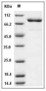 Mouse SRC Kinase / Proto-oncogene c-Src Protein (His & GST Tag) SDS-PAGE