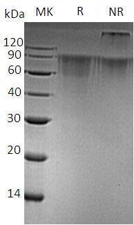 Human THSD1/TMTSP/UNQ3010/PRO9769 (His tag) recombinant protein