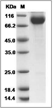 Human CDCP1 / CD318 Protein (Fc Tag) SDS-PAGE