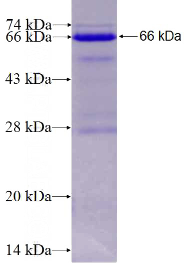 Recombinant Human LEF1 SDS-PAGE