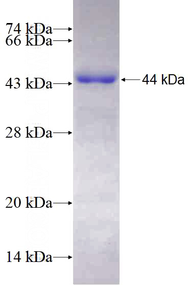 Recombinant Human DLG3 SDS-PAGE