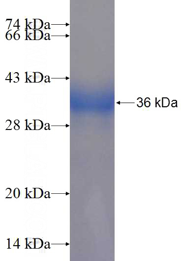 Recombinant Human FAM125A SDS-PAGE