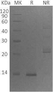 Human ZBED1/ALTE/DREF/KIAA0785/TRAMP (His tag) recombinant protein