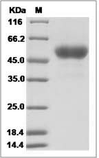 Influenza A H4N2 (A/duck/Hunan/8-19/2009) Hemagglutinin / HA1 Protein (His Tag)