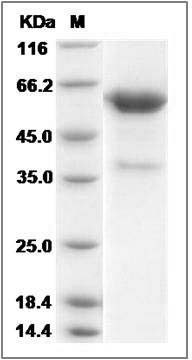 Rat COL4A3 Protein (Fc Tag) SDS-PAGE