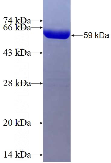 Recombinant Human ACTN4 SDS-PAGE