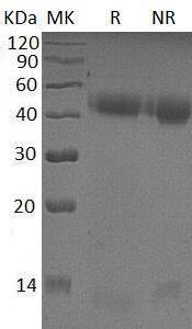 Human PSG2/PSBG2 (His tag) recombinant protein
