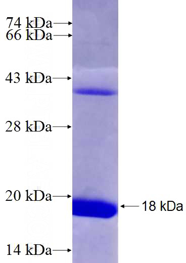 Recombinant Human WBSCR22 SDS-PAGE