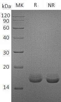 Human CALM1 recombinant protein