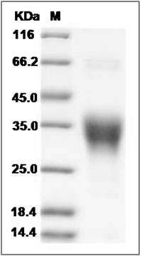 Human Ephrin-B2 / EFNB2 Protein SDS-PAGE