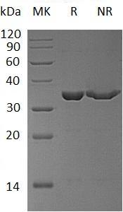 Human PPIE/CYP33 (His tag) recombinant protein