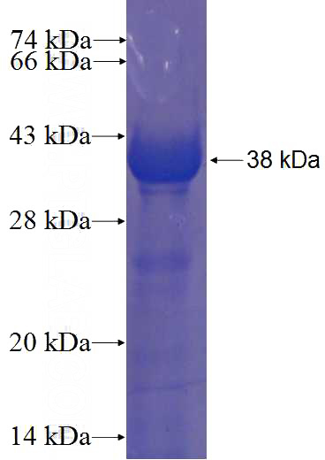 Recombinant Human ARMCX5 SDS-PAGE