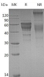 Mouse Havcr2/Tim3/Timd3 (Fc tag) recombinant protein