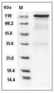 Rat HER2 / ErbB2 Protein (Fc Tag) SDS-PAGE