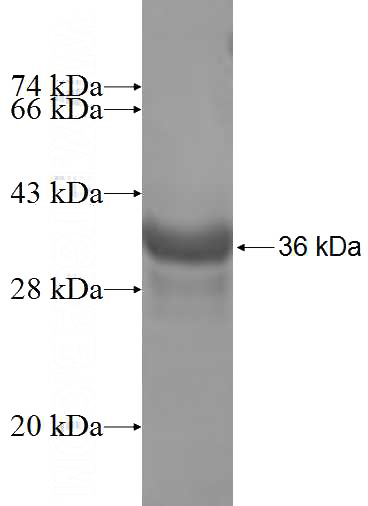 Recombinant Human RPS27L SDS-PAGE