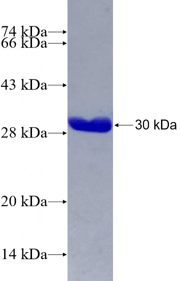 Recombinant Human C1orf103 SDS-PAGE