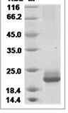 Human IFNA10 recombinant protein (C-His)