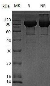 Human GLB1/ELNR1 (His tag) recombinant protein