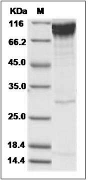 Human ECD / Ecdysoneless homolog Protein (His & GST Tag) SDS-PAGE