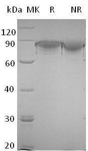 Human FLRT2/KIAA0405/UNQ232/PRO265 (His tag) recombinant protein