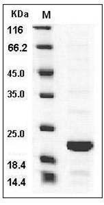 Human BID Protein SDS-PAGE