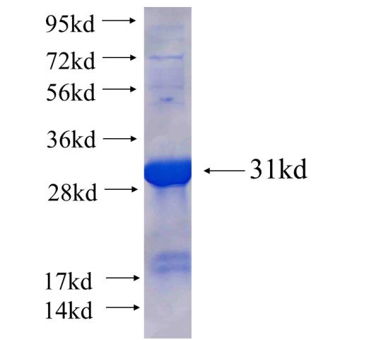 Recombinant human MOBKL2A(Full length) SDS-PAGE