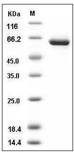 Human USP7 / HAUSP Protein (aa 208-560, His & GST Tag) SDS-PAGE