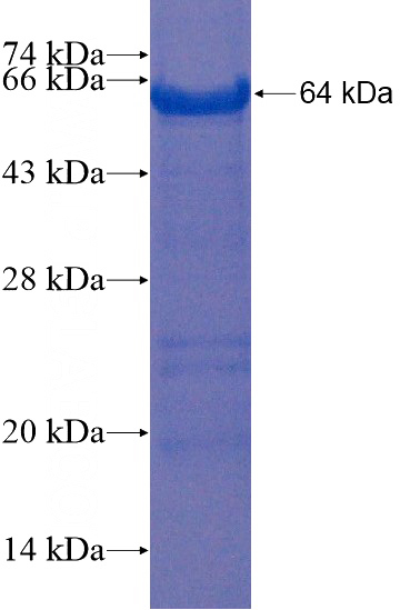 Recombinant Human PRPF39 SDS-PAGE