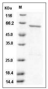 Human CSNK1A1 / CKI-alpha / CK1 Protein (GST Tag) SDS-PAGE