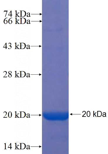 Recombinant Human VSTM2L SDS-PAGE