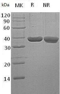 Human LDHA/PIG19 (His tag) recombinant protein