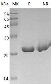 Human SENP8/DEN1/NEDP1/PRSC2/FKSG8 (His tag) recombinant protein