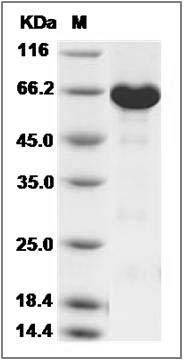 Human ERK3 / MAPK12 / P38-gamma Protein (His & GST Tag) SDS-PAGE