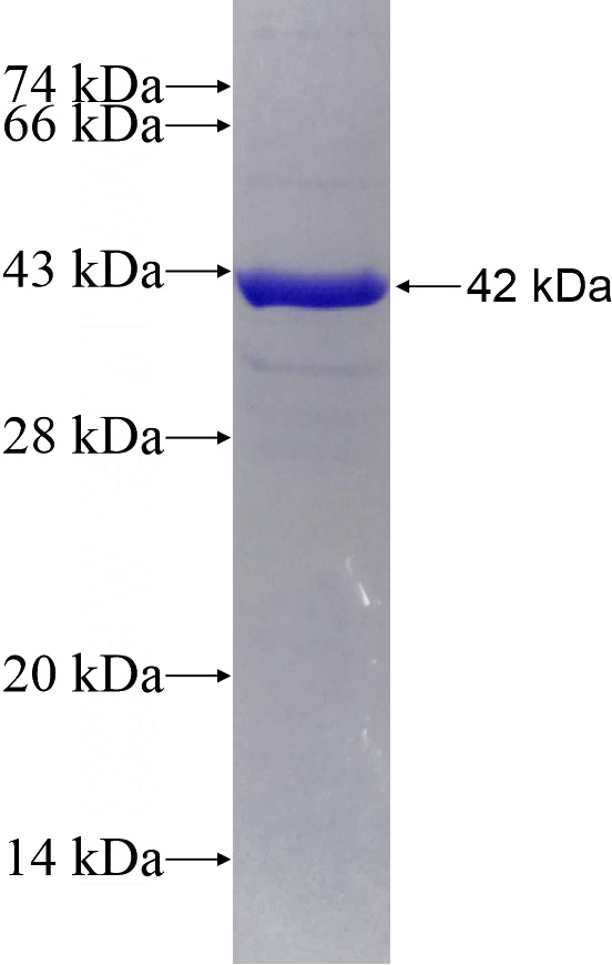 Recombinant Human DNM3 SDS-PAGE