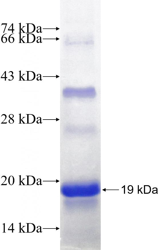 Human TRPM8 Recombinant protein (6*His tag)