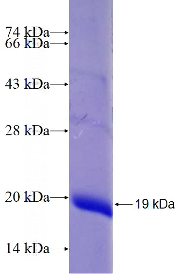 Human JMJD3 Recombinant protein (6*His tag)