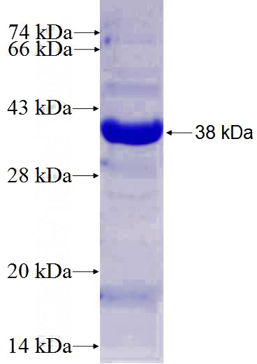 Recombinant Human DYNLT1 SDS-PAGE