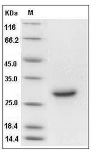 Mouse Syndecan-4 / SDC4 Protein (His Tag) SDS-PAGE