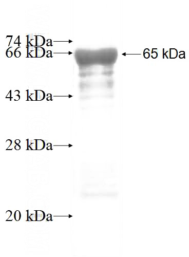 Recombinant Human AIPL1 SDS-PAGE