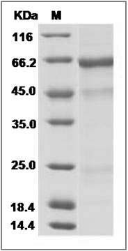 Influenza A H5N1 (A/barnswallow/HongKong/D10-1161/2010) Hemagglutinin / HA Protein (His Tag) SDS-PAGE