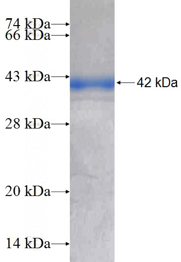 Recombinant Human C20orf195 SDS-PAGE