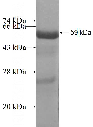 Recombinant Human PARVG SDS-PAGE