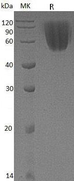 Mouse Sirpa/Ptpns1/mCG_9902 (His tag) recombinant protein