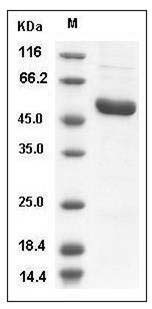 Human IRAK4 / IRAK-4 Protein (His Tag) SDS-PAGE