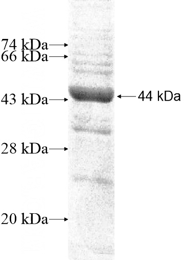 Recombinant Human RASGEF1A SDS-PAGE