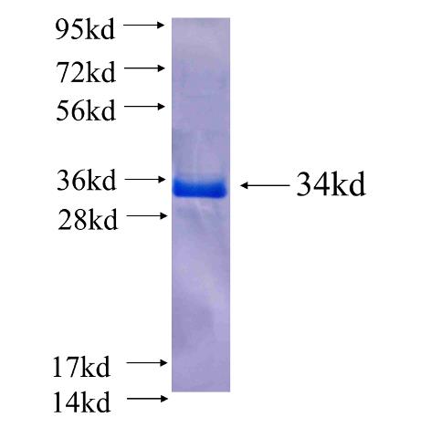 Recombinant human CPLX4 SDS-PAGE