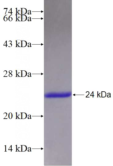 Recombinant Human NUDT11 SDS-PAGE