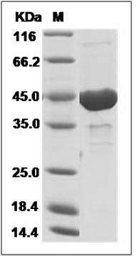 Human Phosphoglycerate Kinase 2 / PGK2 Protein (His Tag) SDS-PAGE