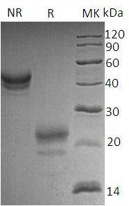 Human CST7 (His tag) recombinant protein